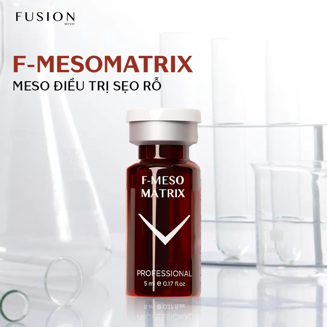F-Mesomatrix Meso Điều Trị Sẹo Rỗ
